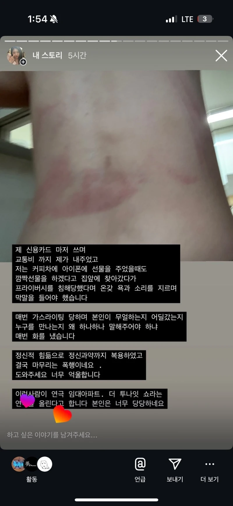 '성병, 폭행' 뮤지컬 배우 폭로 ㄷㄷ-9