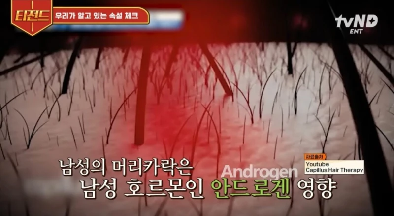 머리 빨리 자라게 하려면 야한생각을 해야한다?-9