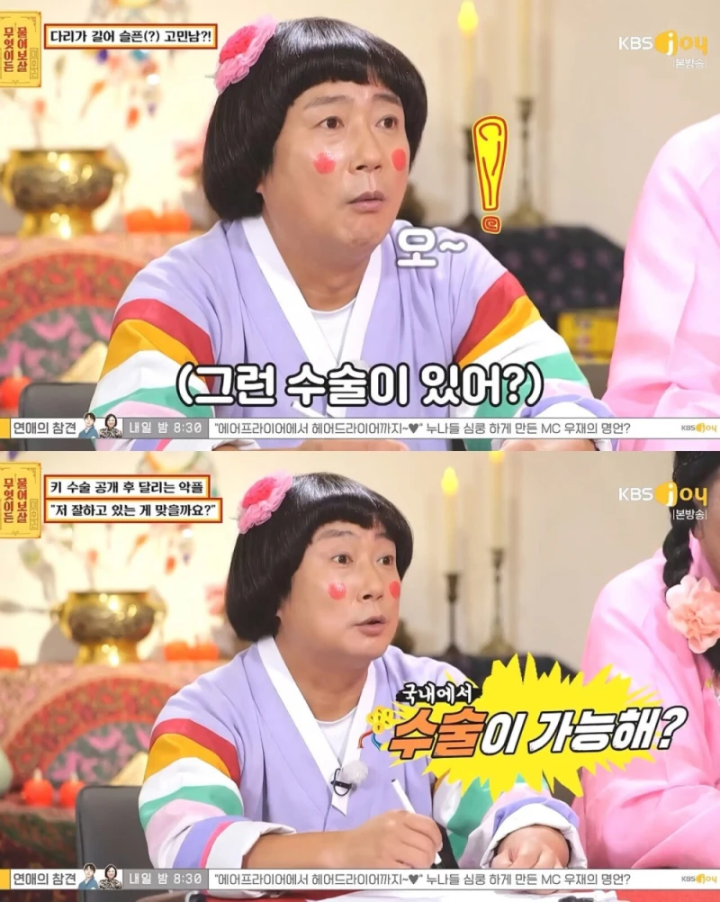 키 수술 성공한 161cm 남성-2