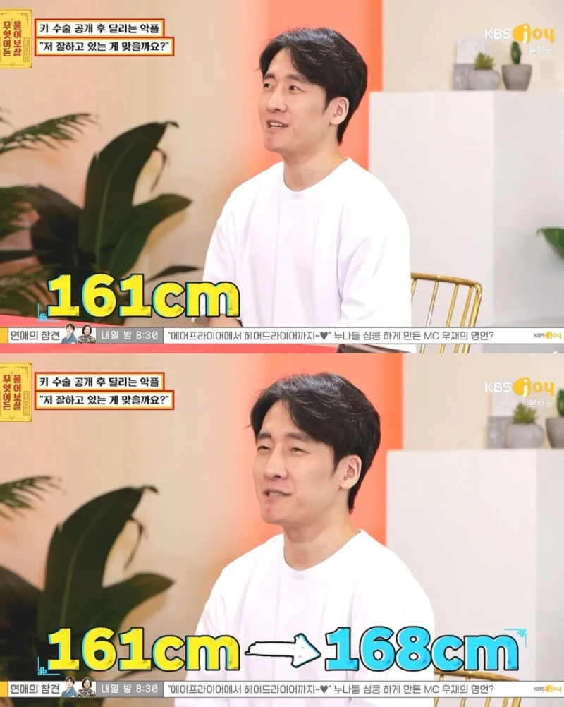키 수술 성공한 161cm 남성-5