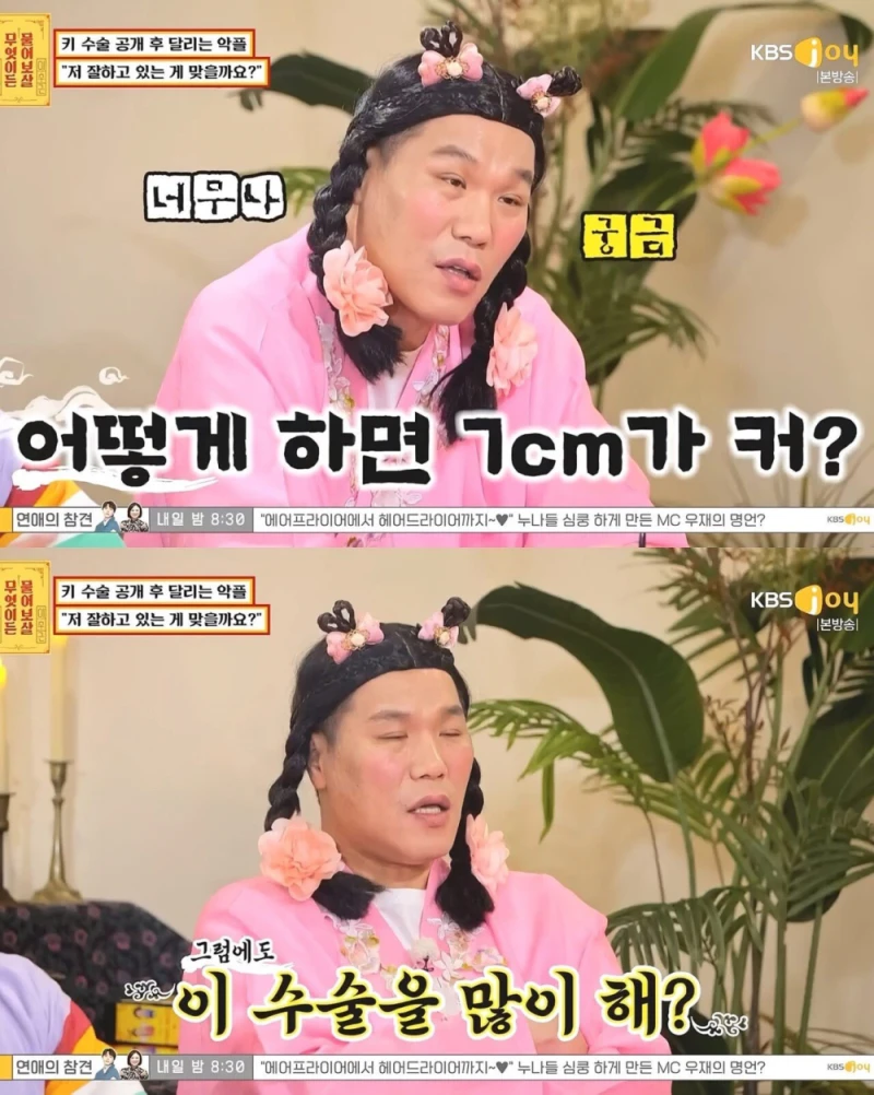 키 수술 성공한 161cm 남성-7