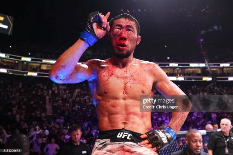 UFC 모르는 사람들이 보면 어이없는거-17