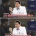 모발 이식후 12년동안 탈모약 안먹음
