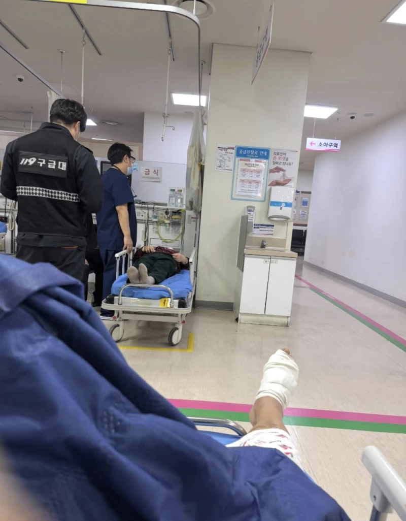 전기장판 저온화상으로 발가락 절단한 사람 -2