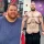 혐주의) 160kg 감량한 사람의 피부 상태