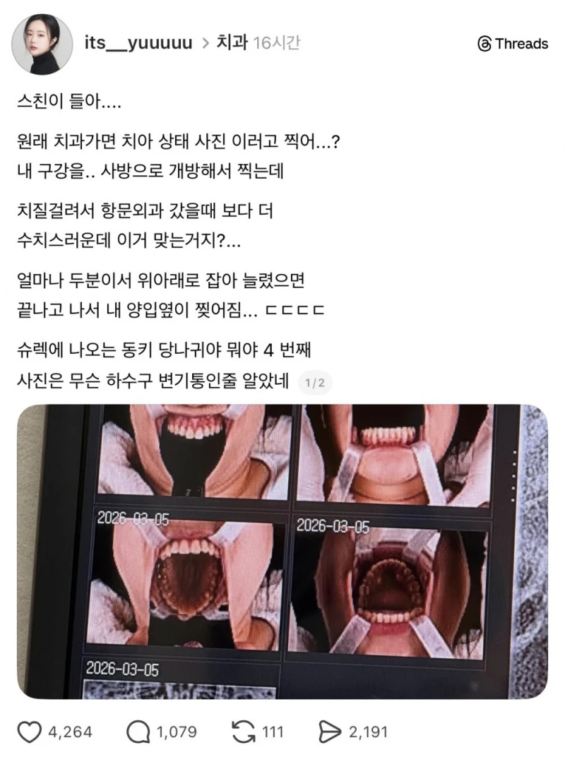 원래 치과가면 치아 상태 사진 이러고 찍어..?