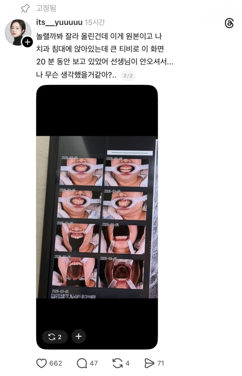 원래 치과가면 치아 상태 사진 이러고 찍어..?-2