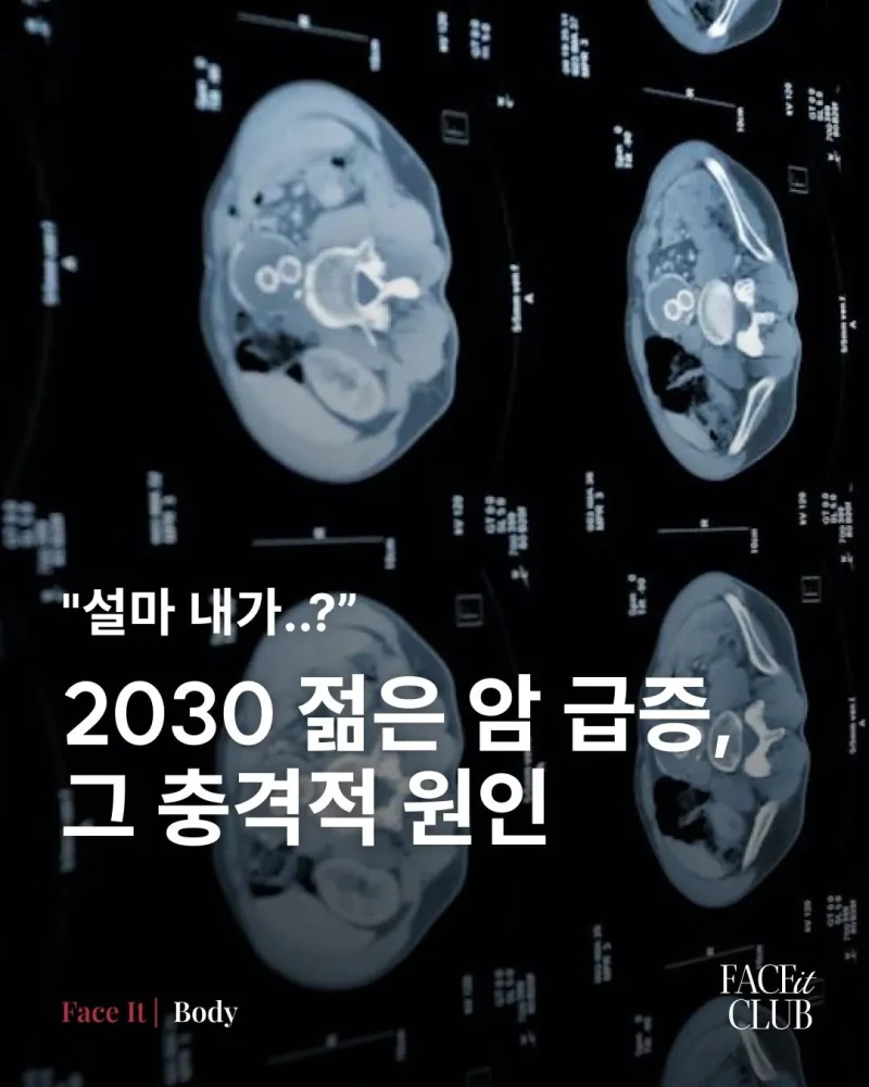 2030 젊은 암 급증, 그 충격적 원인