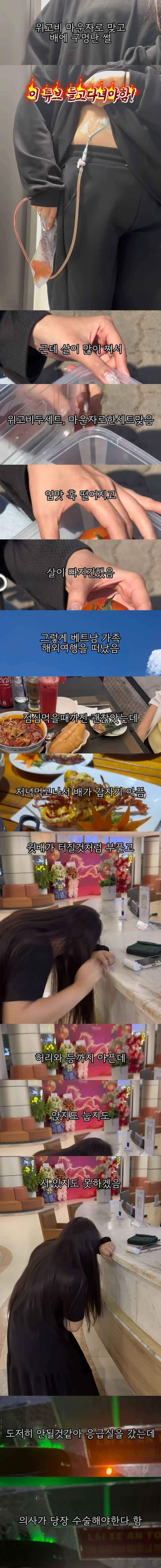 위고비 마운자로 맞고 배에 구멍난 썰