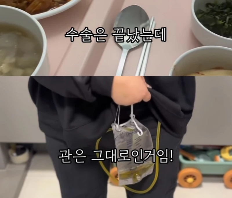 위고비 마운자로 맞고 배에 구멍난 썰-4