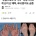 &#034;콘돔으로도 못 막아&#034; 전세계 난리