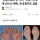 &#034;콘돔으로도 못 막아&#034; 전세계 난리